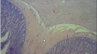 Plexos de Meissner y Auerbach en el intestino delgado