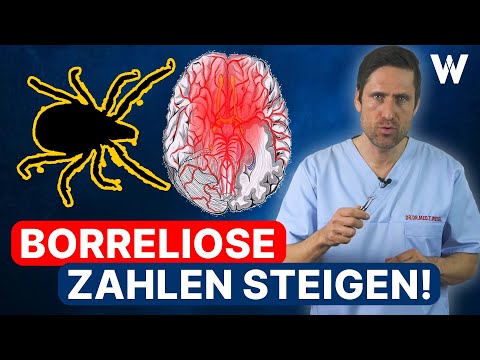 Zeckenalarm: Borreliose-Symptome erkennen! Die Gefahr der Neuroborreliose | Borreliose-Behandlung