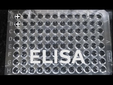 ELISA | How to do ELISA | step by step procedure for ELISA