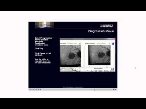 SPECTRALIS RegionFinder