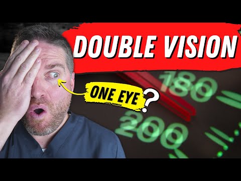 5 Causes Of Double Vision In One Eye (Monocular Diplopia)