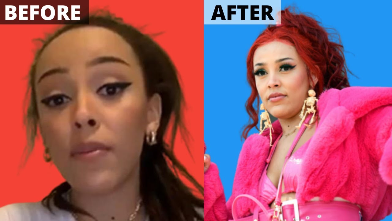 Doja Cat Before And After Weight Loss