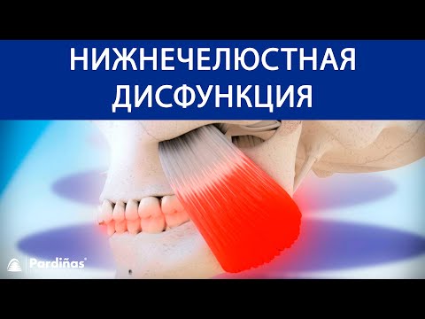 Бруксизм и височно-нижнечелюстная дисфункция ©