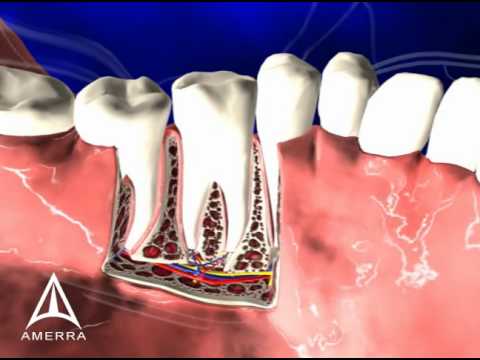 Tooth Anatomy - 3D Medical Animation