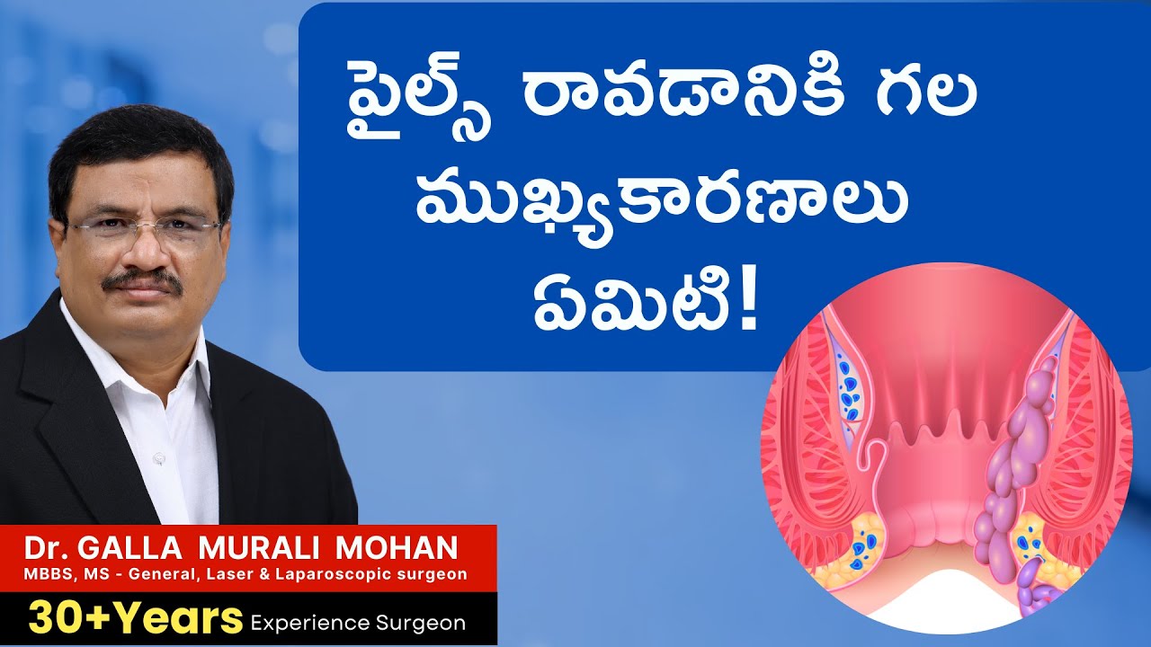 Piles Laser Treatment Video 4