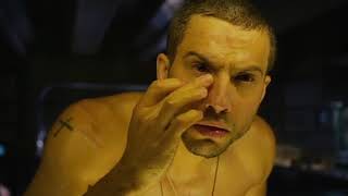 [問卦] 眼睛感覺有變形蟲與黃色網子