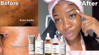 PRODUCTS THAT REMOVE DARK MARKS & TEXTURED SKIN FAST | The ordinary