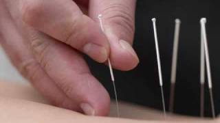 Acupuntura Cursos