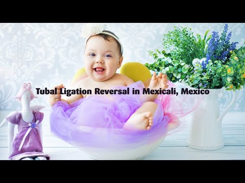 Watch Video on Affordable Tubal Ligation Reversal in Mexicali, Mexico