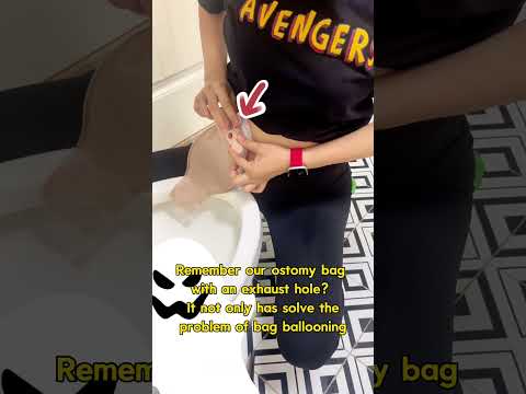 Let me show you how to quickly clean an #ostomybag  in 2 minutes😎 #ostomy #colostomy #ostomate