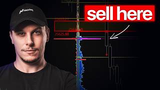 How To Find The BEST Entry Zones