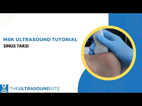 MSK ultrasound evaluation of the Sinus Tarsi