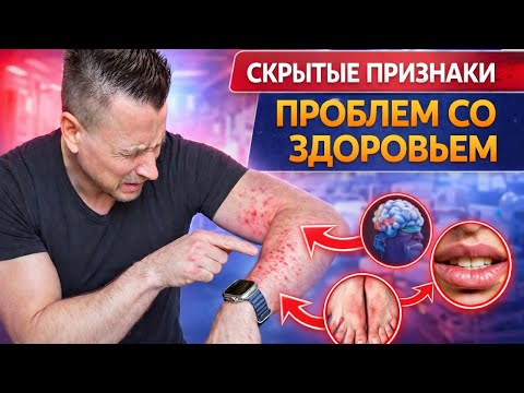 Скрытые признаки проблем со здоровьем, которые ты игнорируешь!