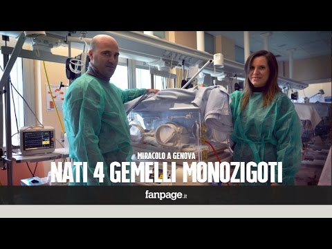Il pigmentary nota su pelle a sfingi Le gocce spargono tonfi di lentiggini lamicizia solo solida per non versare lacqua