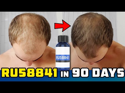 RU58841 Solo 90 Day Results - Newbie Explanation Of Topical Anti-Androgens For Hair Loss Prevention