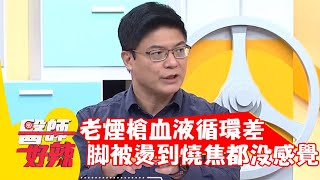 老煙槍血液循環差，腳被燙到燒焦都沒感覺？！【#醫師好辣】20211223 part1 EP1258 胡瓜 黃彥鈞