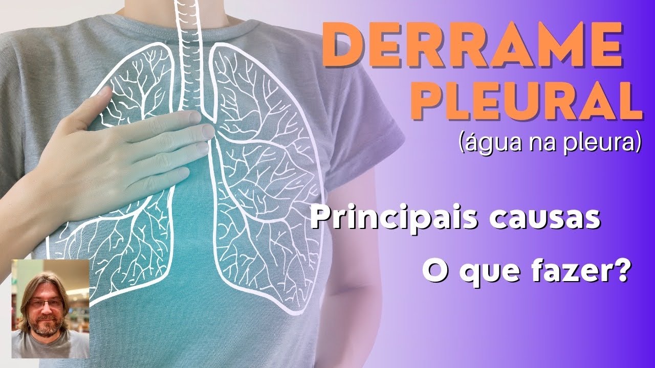 Derrame pleural (água na pleura): saiba quais são as 3 causas mais comuns