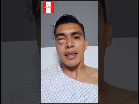 This is how Tala Rangel looked after his clash with Pollo Briseño 🥺🐐❤️ | Chivas 4-1 Atlas | #foot...