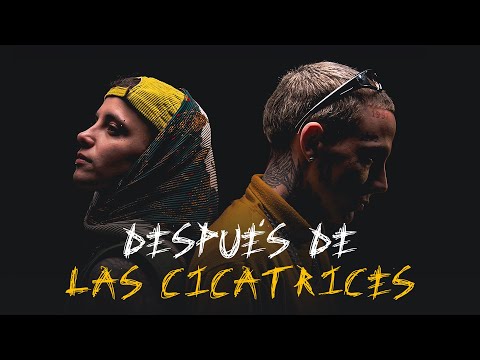Valen Etchegoyen & Coco Swing - Después de las Cicatrices (Video Oficial)