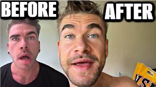 I AM NO LONGER PARALYZED - HOW I "CURED" RAMSEY HUNT SYNDROME Joel Hansen