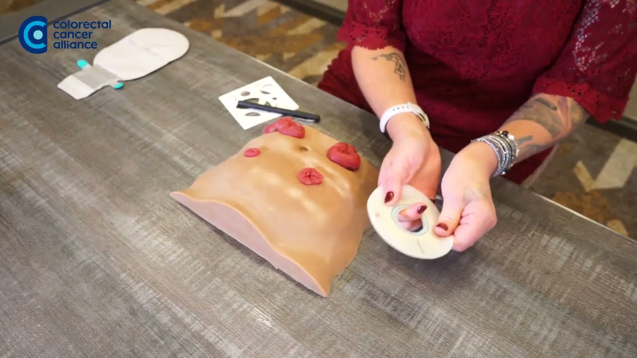 How to Cut and Fit an Ostomy Wafer for a Stoma