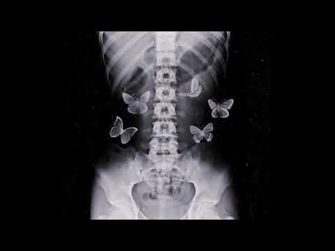 [FREE] killval x juice wrld type beat - "inconsiderate" | prod. june x prod. 05