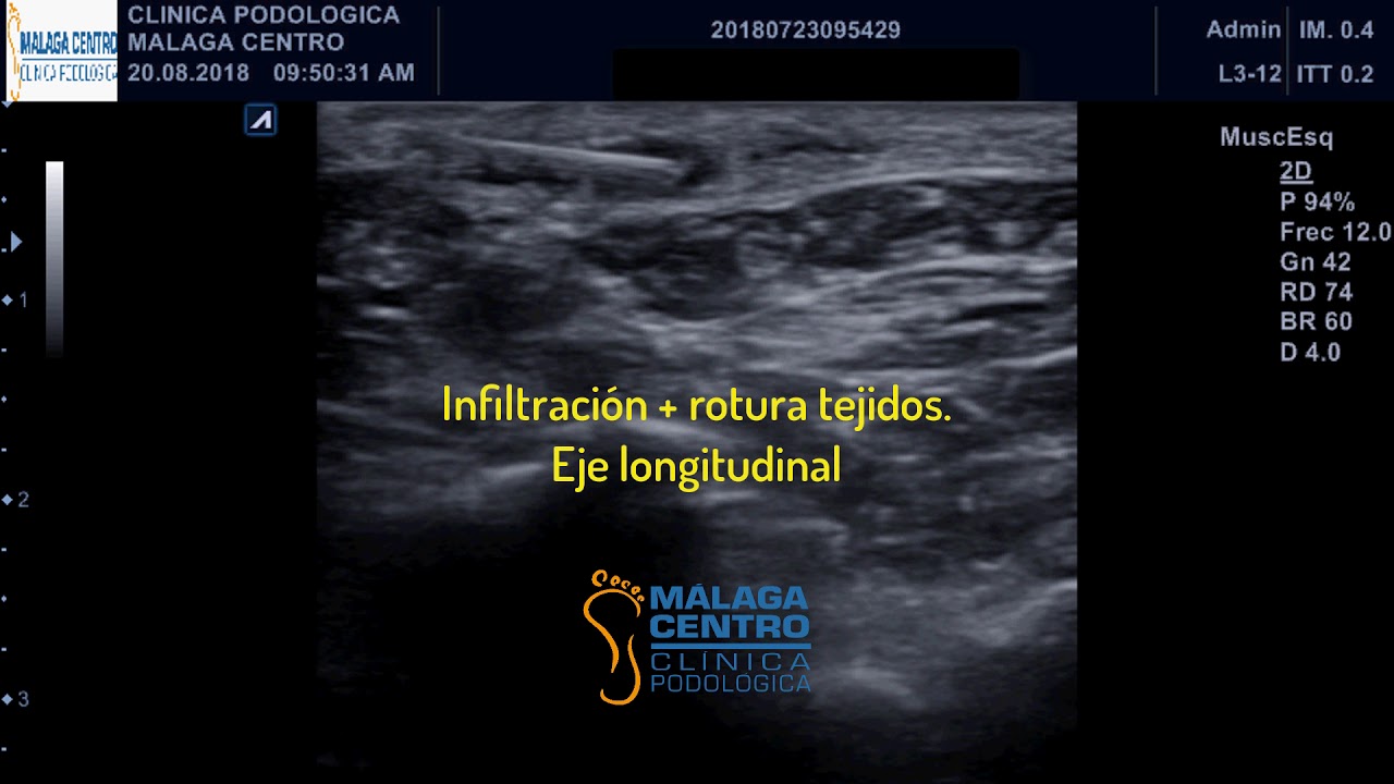 Francisco José Ariza Zafra-53