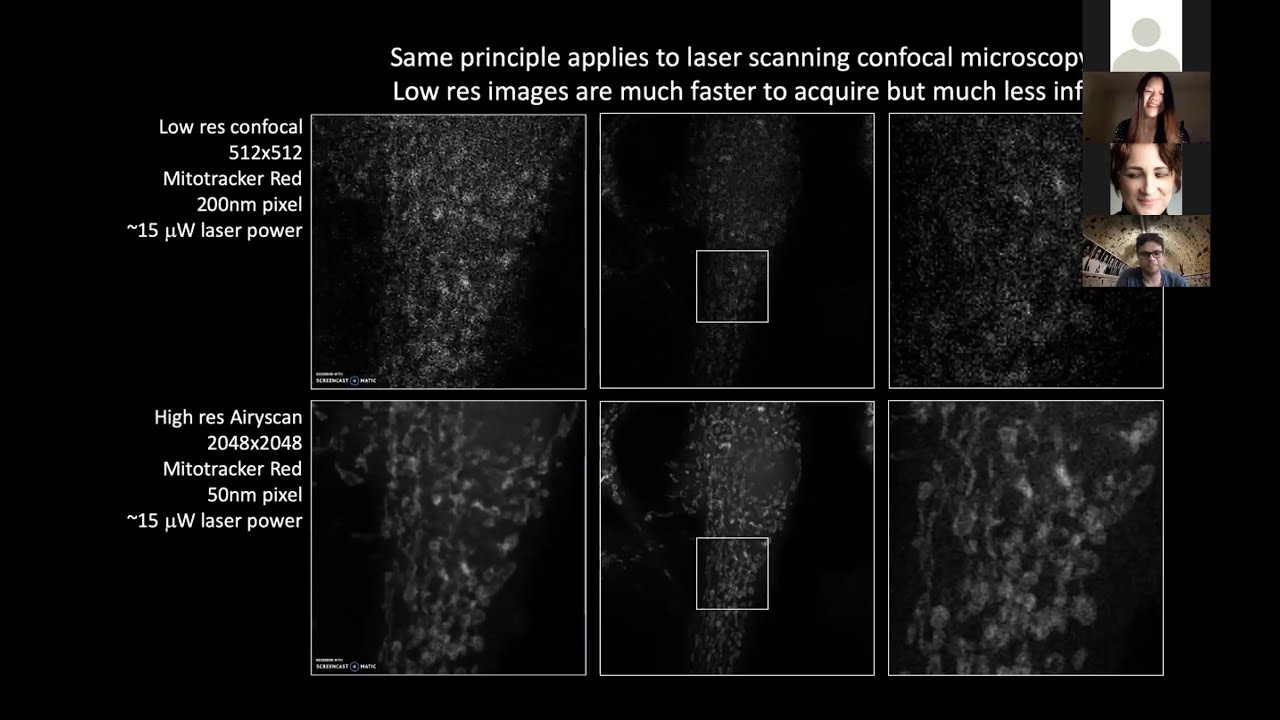 Linjing Fang - Deep learning-based point scanning super resolution imaging - Imaging ONEWORLD