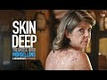 Skin Deep: The Battle Over Morgellons - Trailer