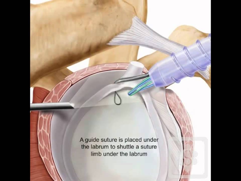 Roberto Postacchini-13