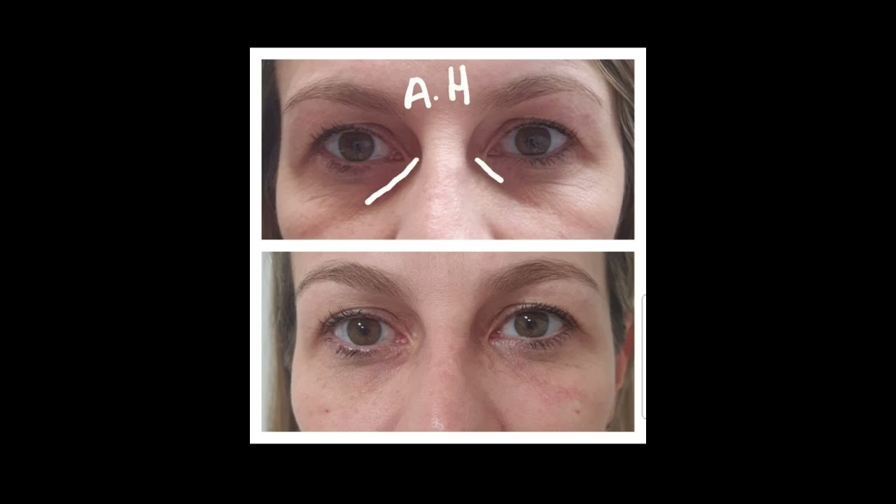 Sergio Moreira Dos Santos Junior-8