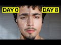 How To Get Clear Skin For Guys ASAP