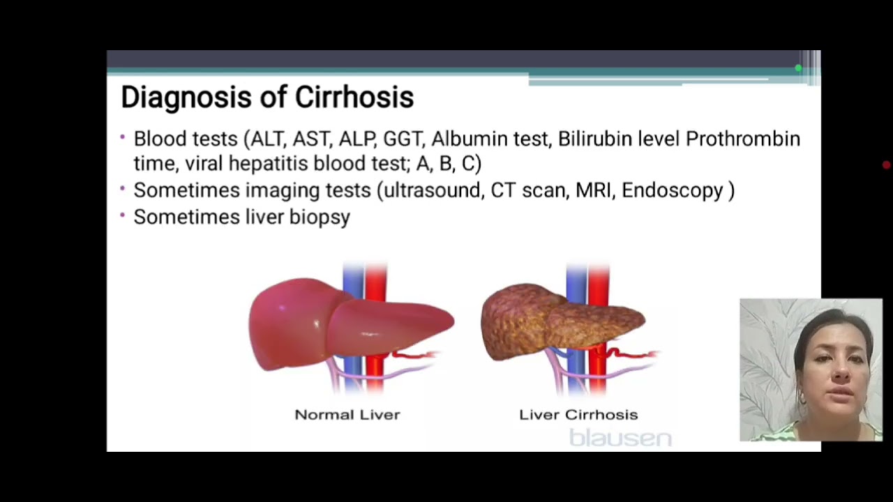 Biochemical analysis of blood