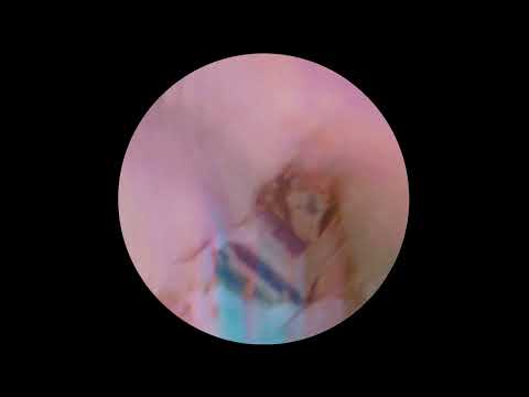 Dream Escape (Luca Bacchetti Endless Remix)