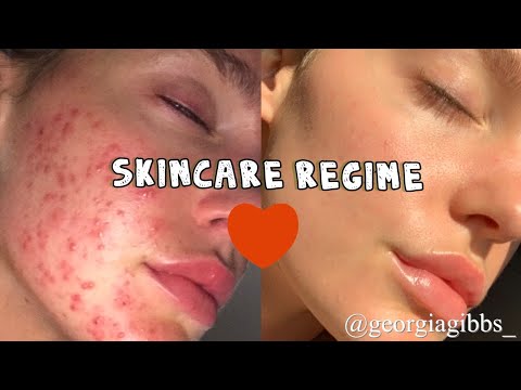My skincare routine | bye bye acne & irritated skin | Georgia Gibbs unfiltered thumnail