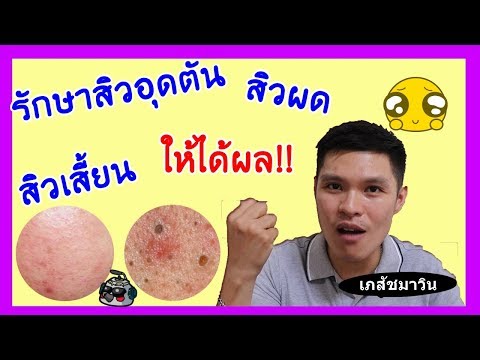 ลดลงค้อนของ ธ อร์ซื้อแคนาดา ค้อนพรูพรูสทิ