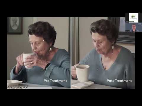 Treating Hand Tremors with the Cala TAPS Therapy