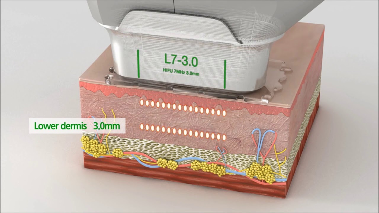 José Cortés Arreguin-39