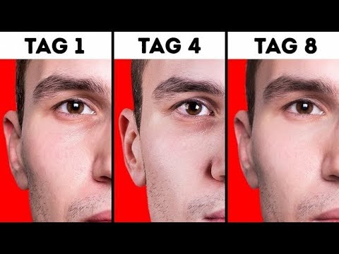 Diabetisches Koma, Erste-Hilfe Vitamine für Diabetiker Typ 2 Evalar