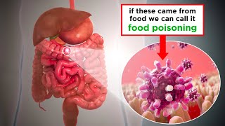 Food Poisoning Shiga Toxin Producing E coli Mp4 3GP & Mp3