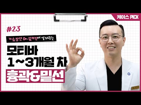 A컵 에서 C컵 가슴수술 3개월 후기 I 심한 흉곽 비대칭 I 밑선 비대칭 I 모티바 미니 & 모티바 풀 보형물 I 오목가슴수술 | 윈느성형외과 라벨윈느 유튜브 영상