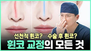 코가 삐뚤어졌다면?수술전후 휜코 , 콧구멍비대칭 완벽정리