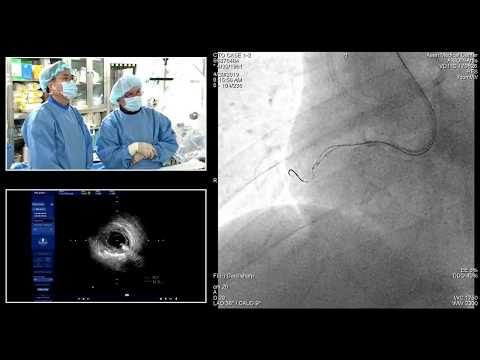 [TCTAP 2019] Master the CTO - Live Case & Lecture Session I