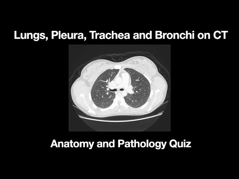 The Lungs, Pleura, Trachea and Bronchi Anatomy and Pathology Quiz