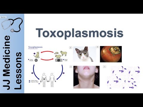 Toxoplasmosis | Acquired vs Congenital | Signs, Symptoms, Diagnosis and Treatment