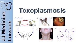 Toxoplasmosis | Acquired vs Congenital | Signs, Symptoms, Diagnosis and Treatment