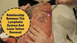 Relationship Between The Lymphatic System And Laser Tattoo Removal