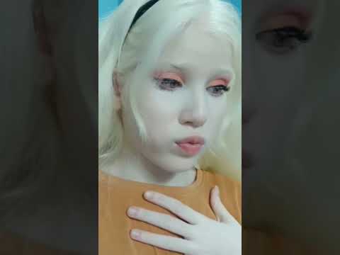 What is albinism?? Answering all your questions #shorts #albino #albnism #questions