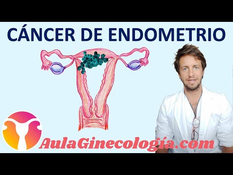 Endometrial Cancer I: Causes, Symptoms, Types, Stages, Diagnosis... - Gynecology and Obstetrics
