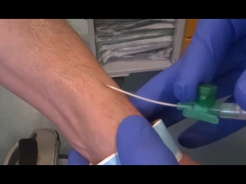 10 Tricks, Tipps zum Legen einer Infusion, Verweilkanüle, für Ärzte und Krankenpfleger.